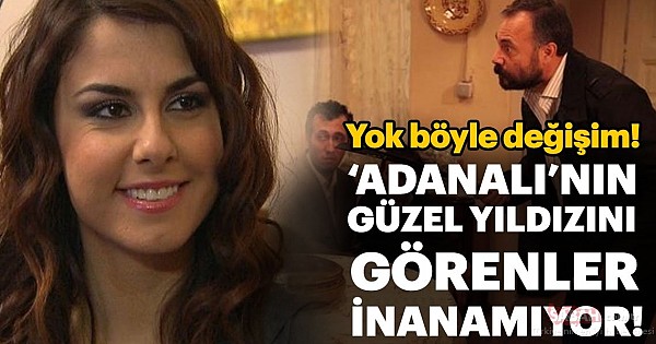 Adanalı dizisinin Pınar'ı Tuğçe Özbudak estetikle bambaşka biri oldu! Görenler tanıyamadı