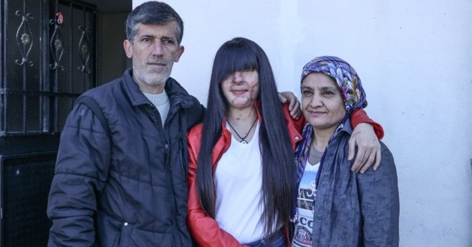 Yüzünü Yakan Kişiyle Evlenen Berfin Özek'in Babası Konuştu