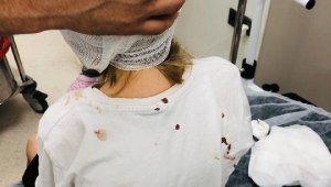 Başakşehir'de saldırıya uğrayan 5 yaşındaki çocuğun kafatası delindi