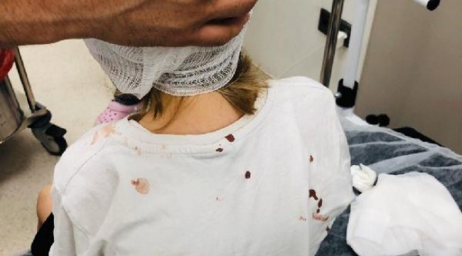 Başakşehir'de saldırıya uğrayan 5 yaşındaki çocuğun kafatası delindi
