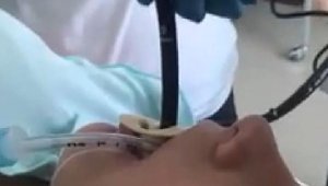Rusya'da bir kadının ağzından yılan çıkarıldı