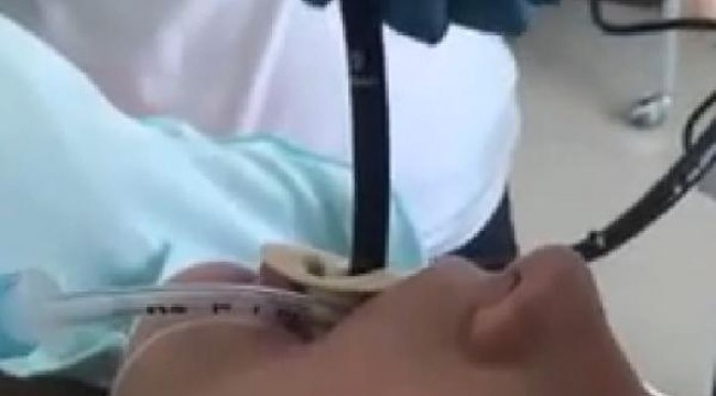 Rusya'da bir kadının ağzından yılan çıkarıldı