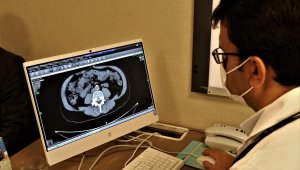 Onkoloji Uzmanı Yerlikaya: Kanser pandemisi bizi bekliyor
